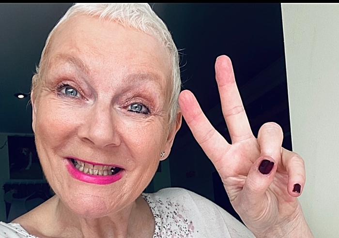 Kim Smith after her cancer treatment